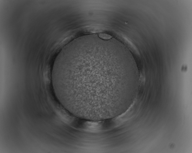 X0000101140170200807071134