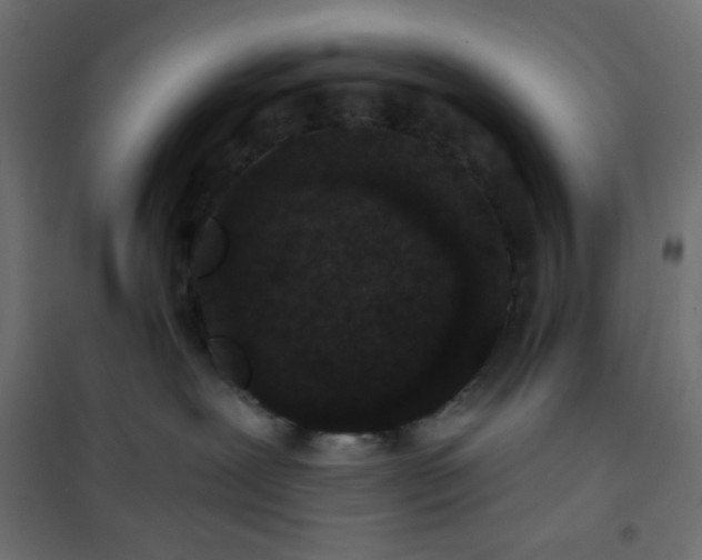 X0000101140239200807071133