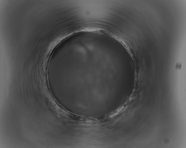 X0000101140337200807071131