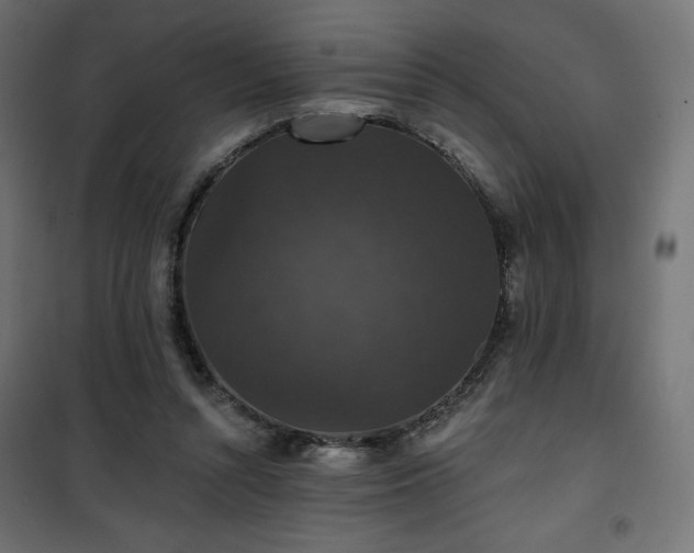 X0000101140352200807071131