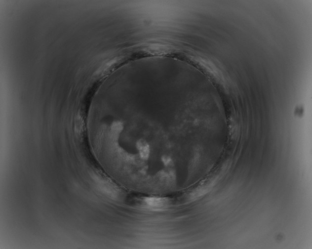 X0000101140371200807071131