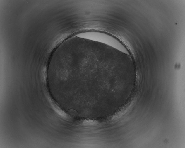 X0000101140397200807071131