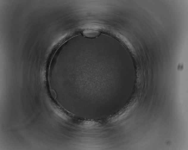 X0000101140399200807071131