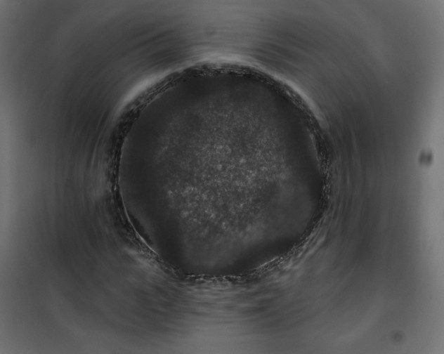 X0000101140919200807071122