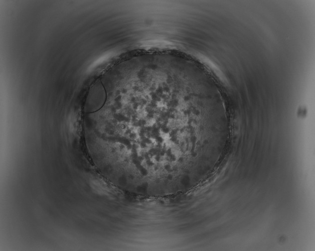 X0000101141063200807071121