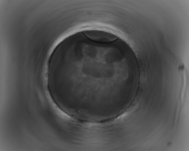 X0000101141522200807071114