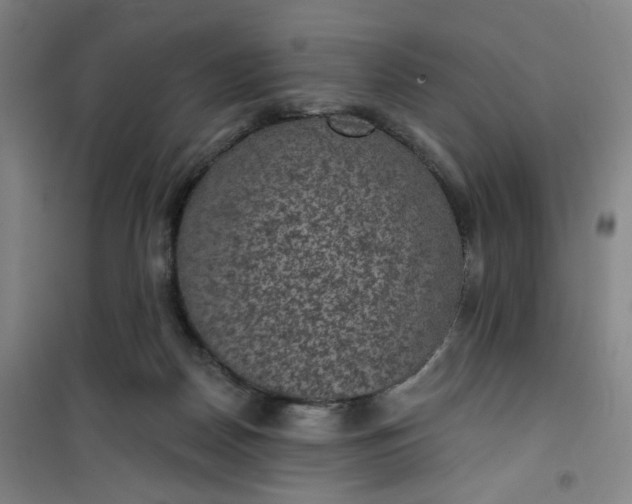 X0000101140170200807110951