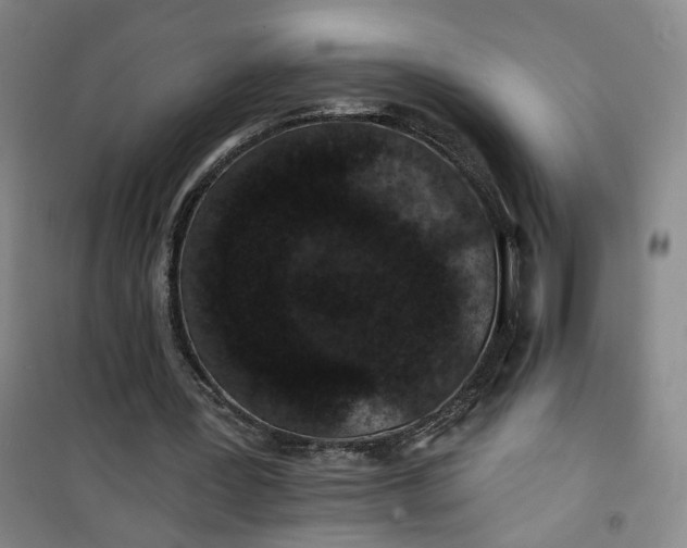 X0000101140387200807110948