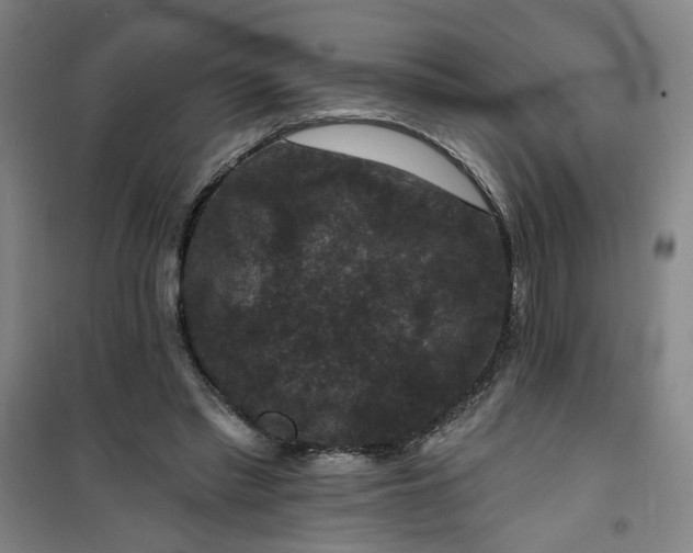 X0000101140397200807110947