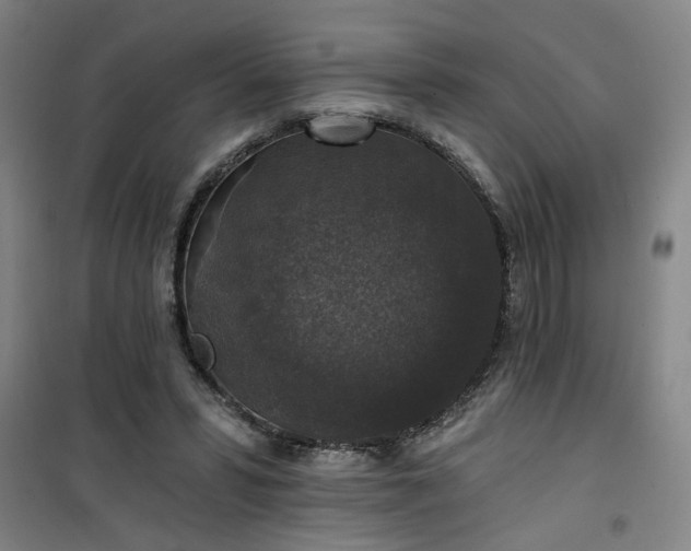 X0000101140399200807110947