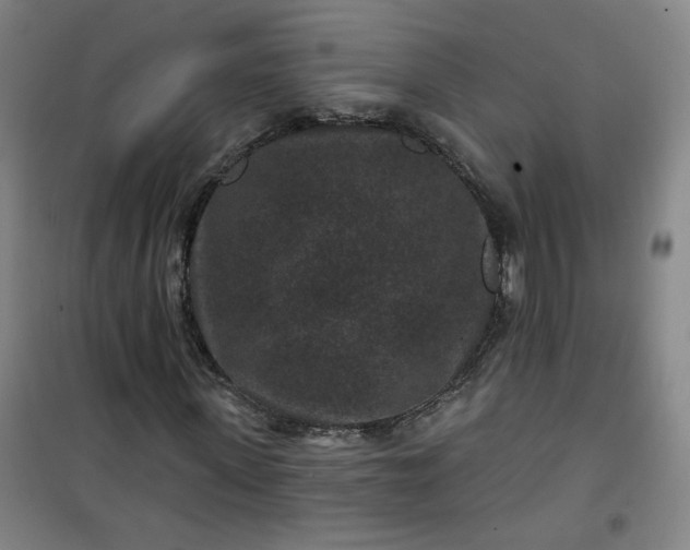 X0000101140915200807110939