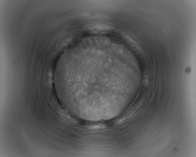 X0000101141108200807110936