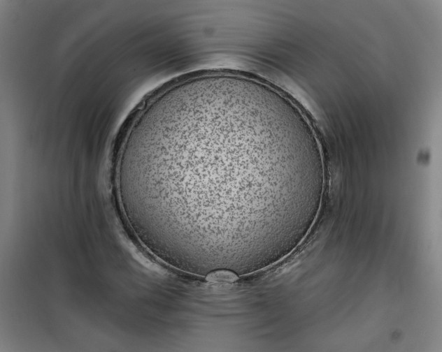 X0000101141116200807110936