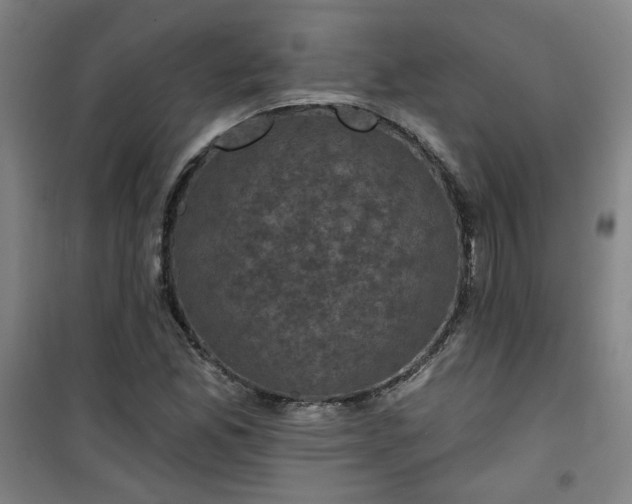 X0000101141165200807110936