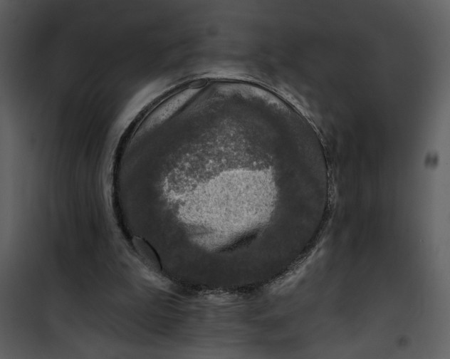 X0000101140199200807181303