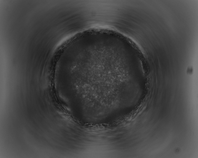 X0000101140919200807181251