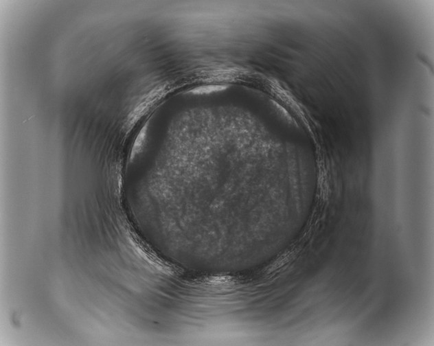 X0000101140059200807251035