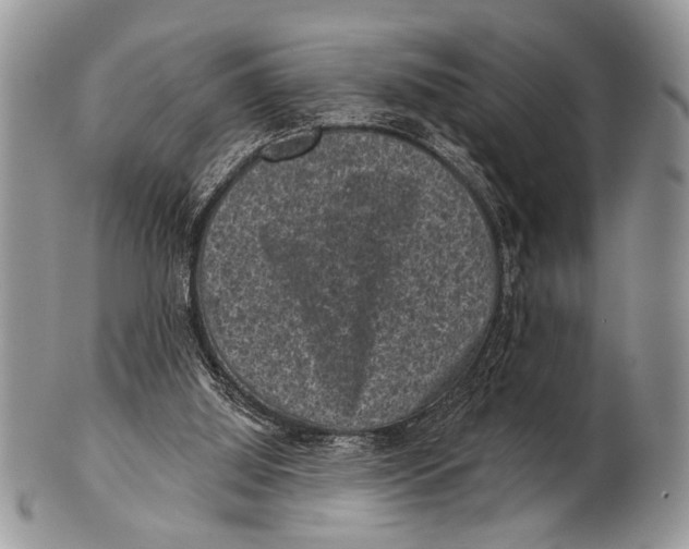 X0000101140060200807251035