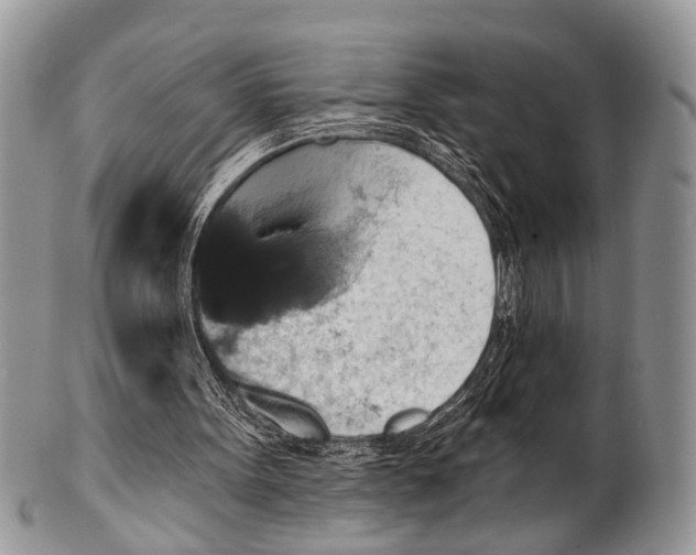 X0000101140099200807251035