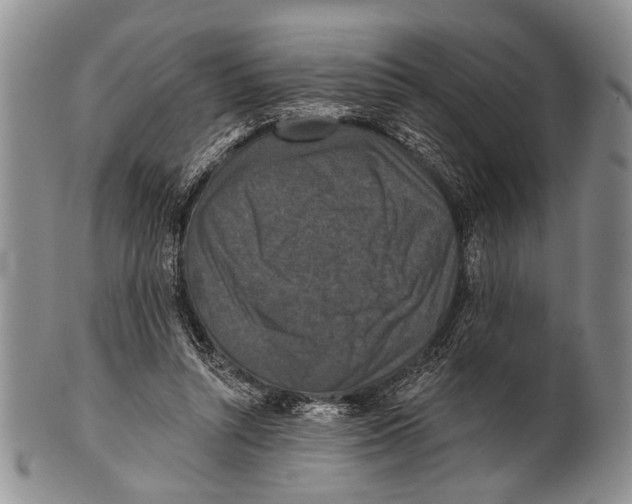 X0000101140352200807251031