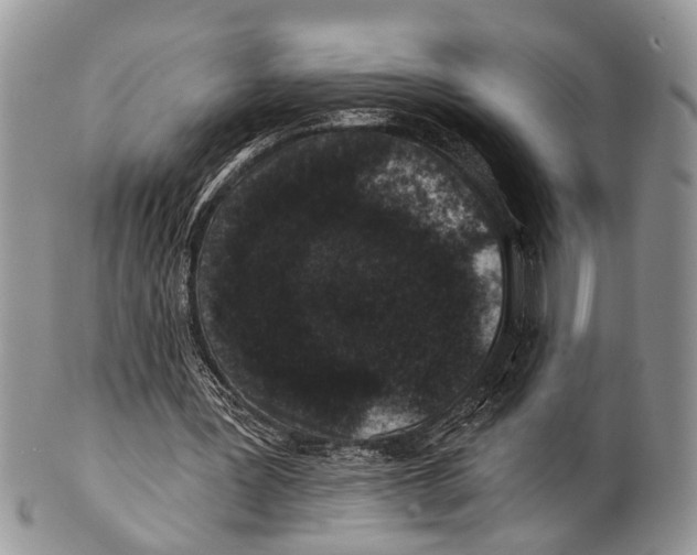 X0000101140387200807251031