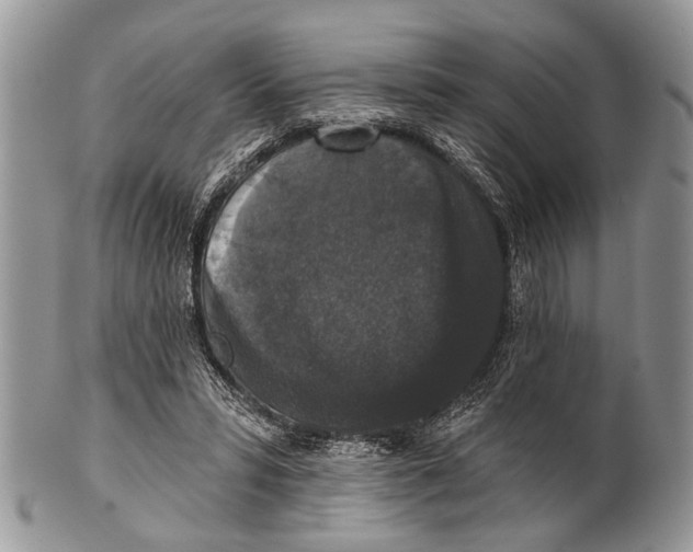 X0000101140399200807251030