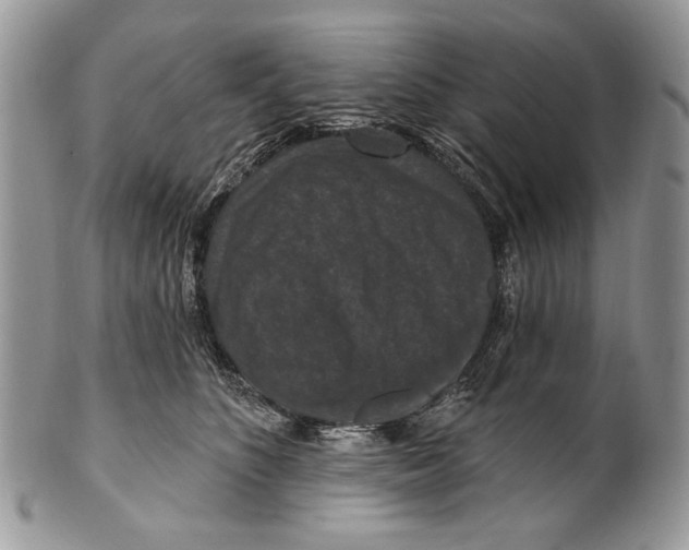 X0000101140516200807251029