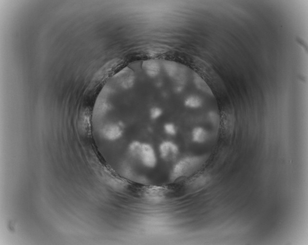 X0000101140527200807251028