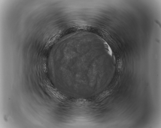 X0000101140916200807251022