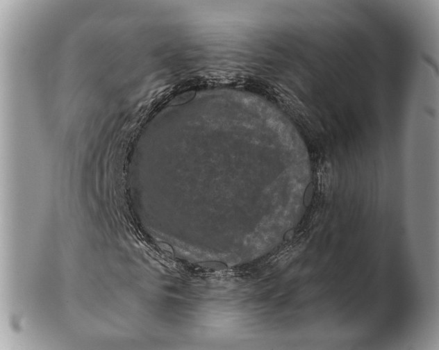 X0000101140961200807251022