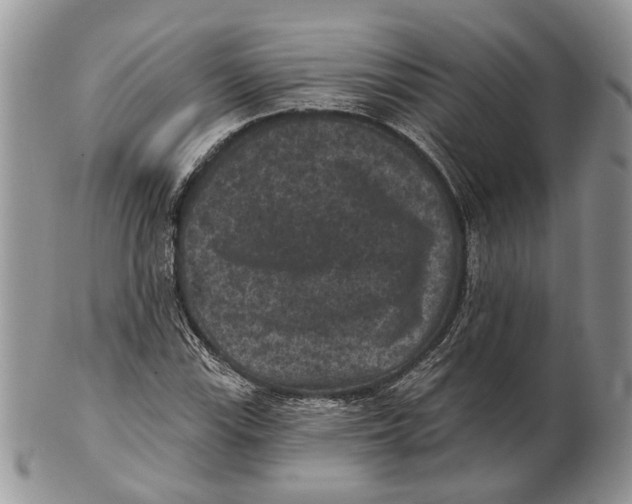 X0000101141115200807251020