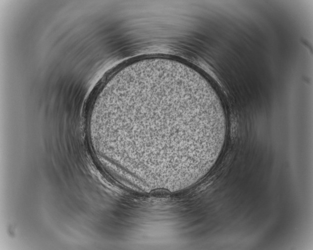 X0000101141116200807251020