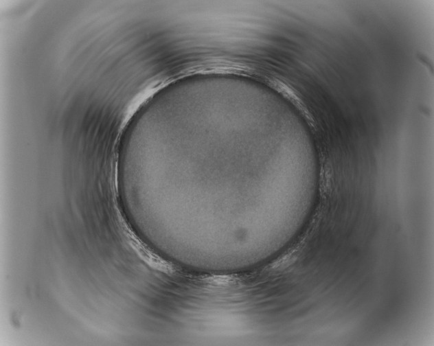 X0000101141130200807251020