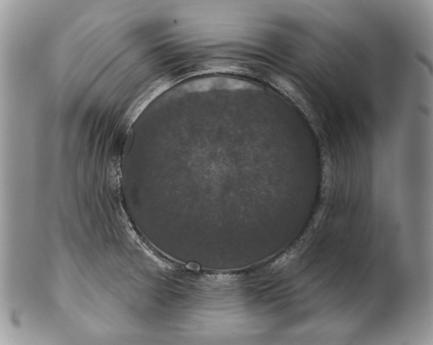 X0000101141377200807251016