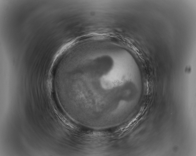 X0000101150149200806270951