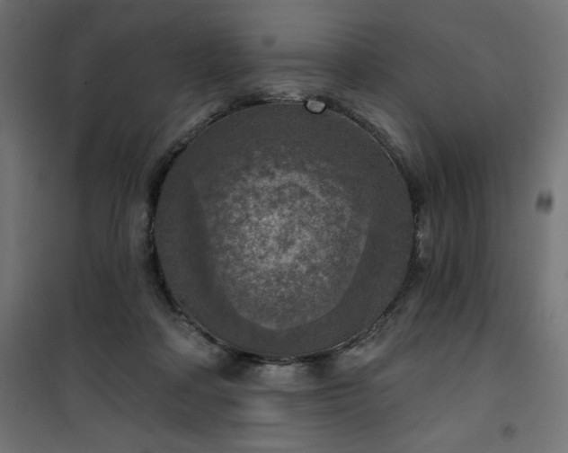 X0000101150314200807071156