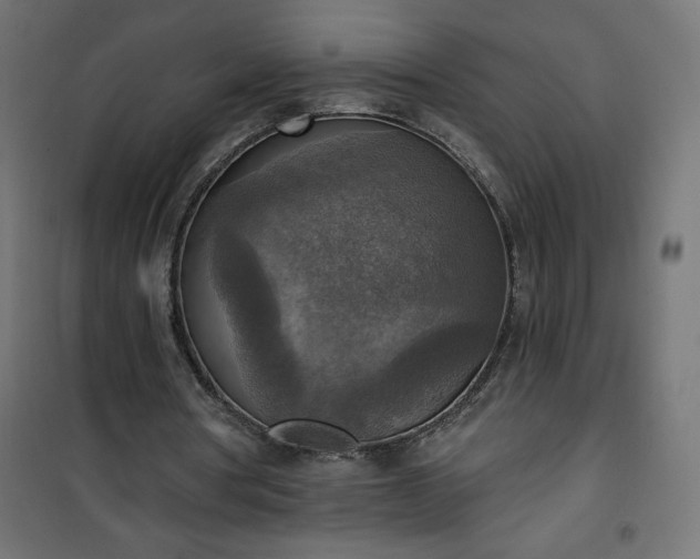 X0000101150386200807071155