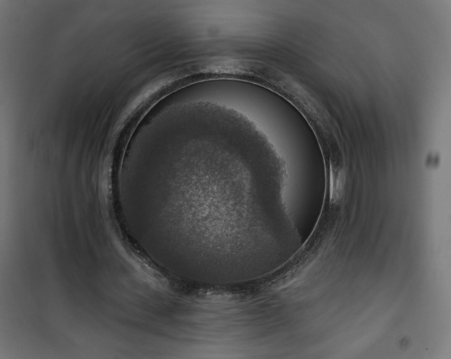 X0000101150531200807071152