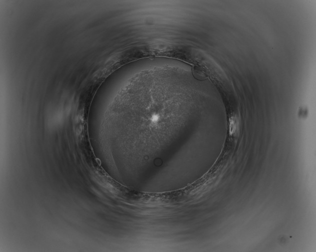 X0000101151011200807071144