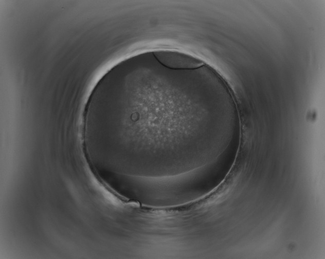 X0000101151527200807071137