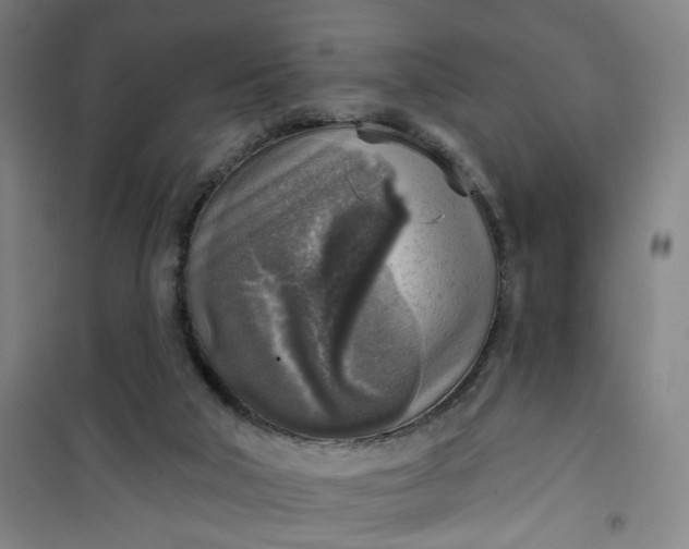 X0000101150018200807111016