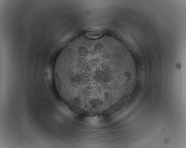 X0000101150131200807111014