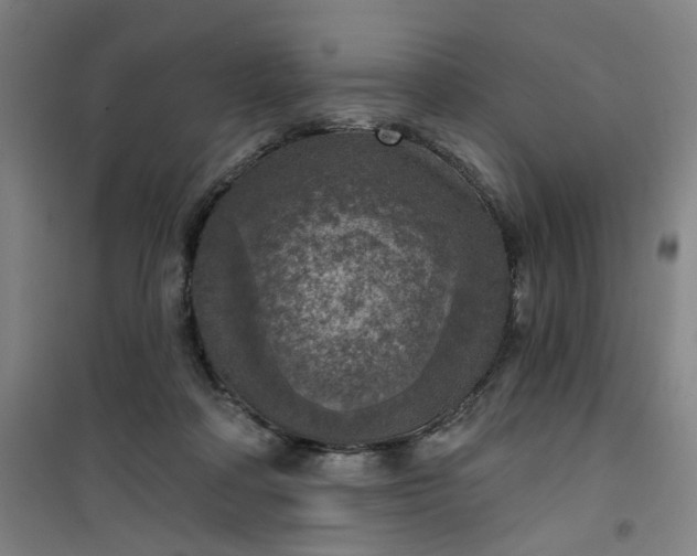 X0000101150314200807111011