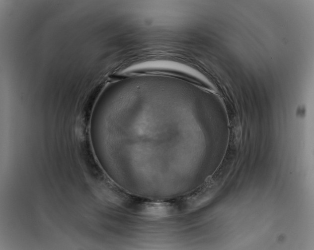 X0000101150316200807111011