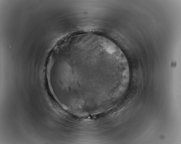 X0000101150592200807111007