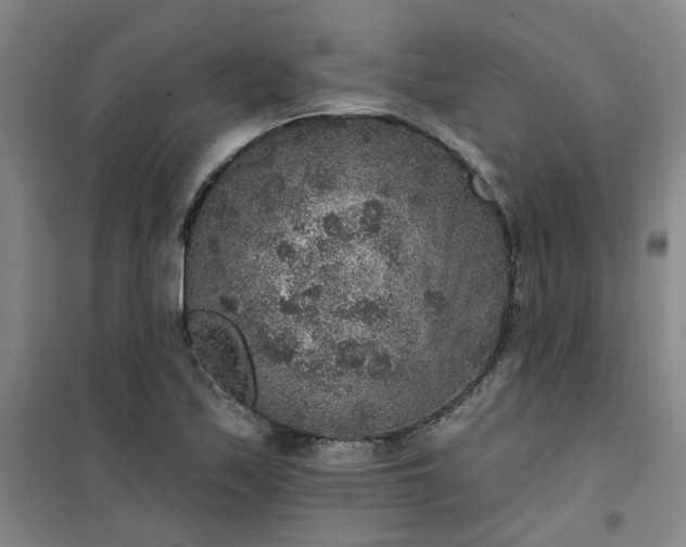 X0000101151171200807110959