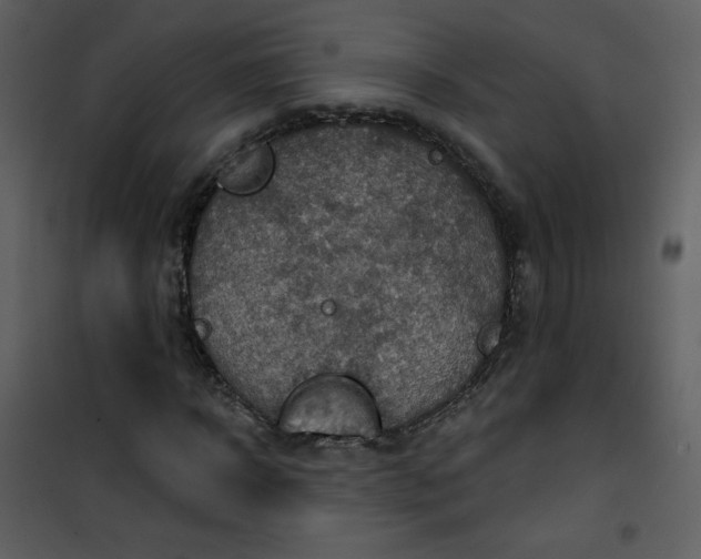 X0000101150918200807181330