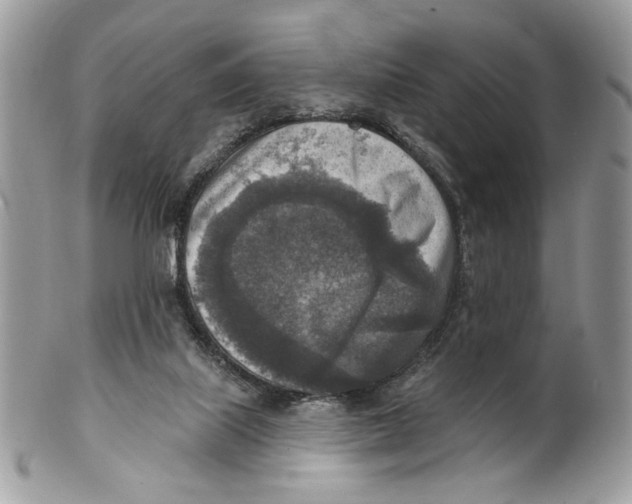 X0000101150067200807251057