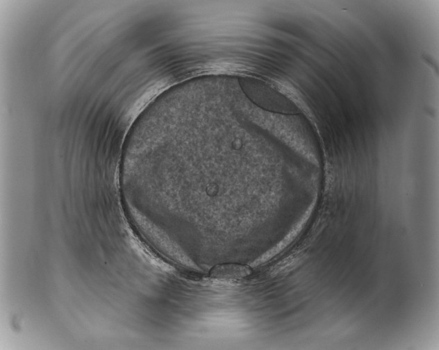 X0000101150946200807251045