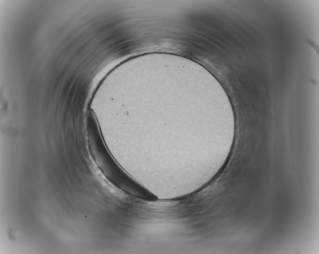 X0000101151200200807251041